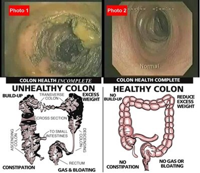 Colon Hydrotherapy 3 modern colon hydrotherapy clinic consultation room with professional equipment